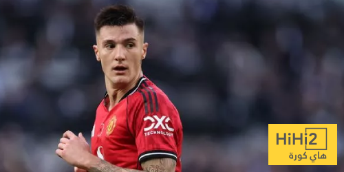 قلق في اليونايتد بسبب سيسكو