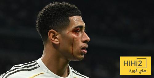 صورة مقربة لإصابة جود بيلينغهام